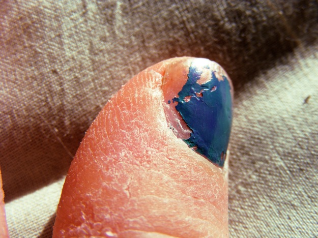 Ugly fingernails